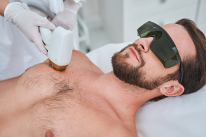 Hombre recibiendo una sesión de depilación láser en el pecho con gafas de protección